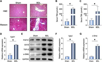 FGF21-dependent alleviation of cholestasis-induced liver fibrosis by sodium butyrate